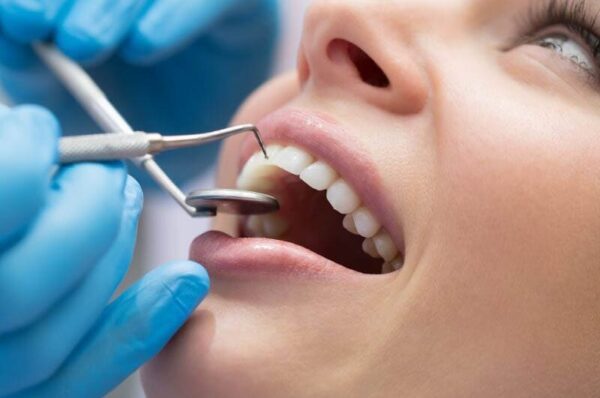 Лікування карієсу та художня реставрація зубів: методи повернення здоров’я та краси посмішки